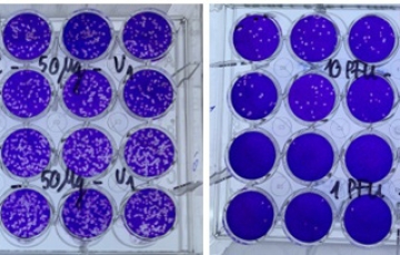 Việt Nam thử nghiệm thuốc điều trị COVID-19 trên người